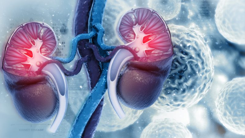 Se incrementan los diagnósticos de cáncer renal en Tamaulipas