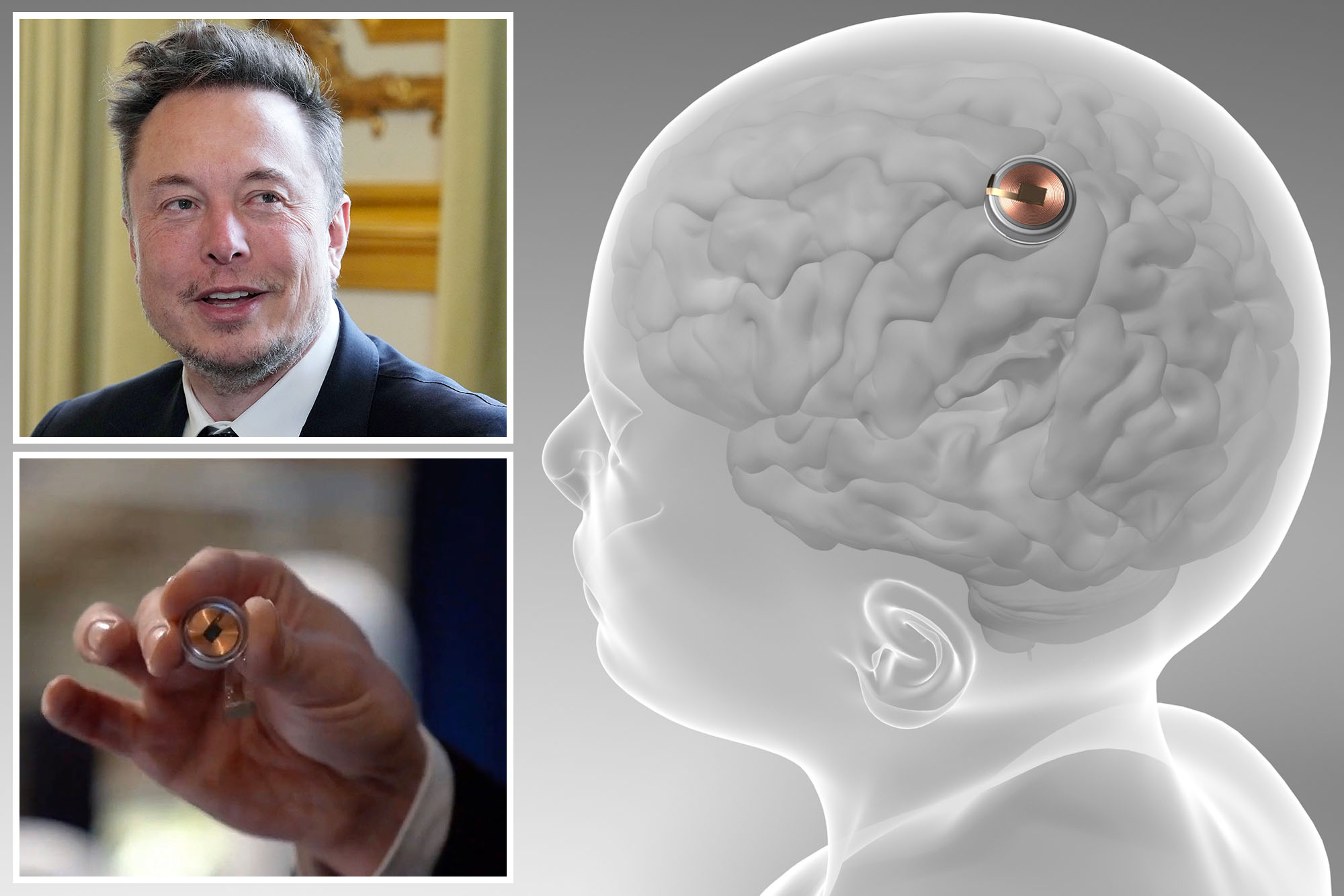 Elon Musk afirma que el último avance de Neuralink podría restaurar la vista a las personas con ceguera