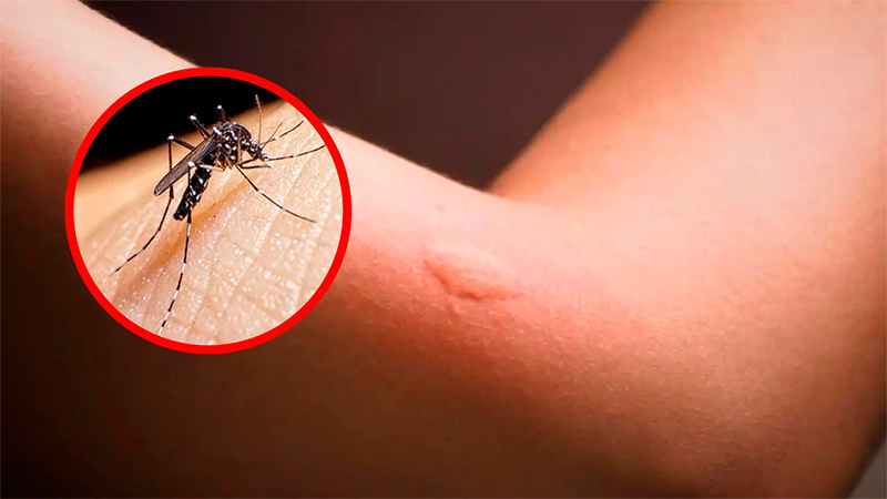 Incremento alarmante de dengue en México deja 20 muertos, informa la SSA