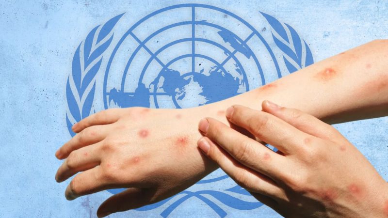 OMS lanza un plan global para combatir el mpox: enfoque estratégico en preparación, respuesta y vacunación dirigida