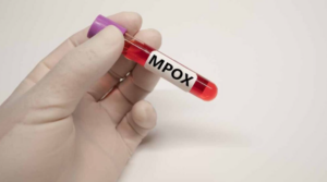 Capacitan a más de 1,600 profesionales de la salud en México para enfrentar la mpox