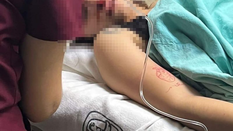 Solicitan Ayuda Económica para Melanie, Joven Violentamente Agredida en Ciudad Madero