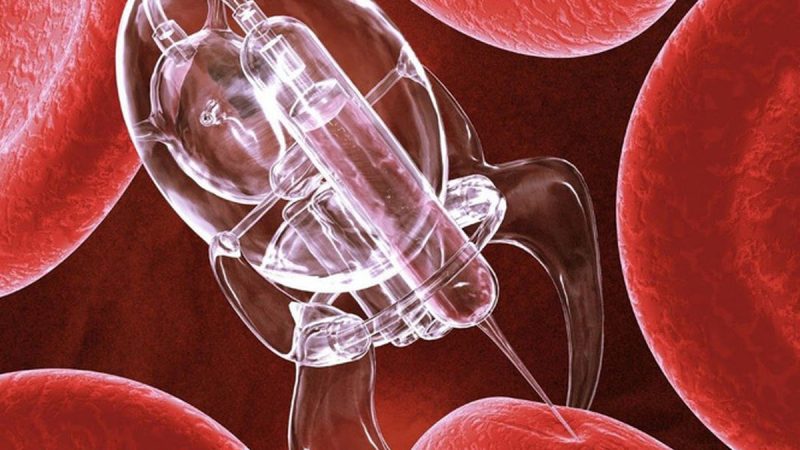 Nanorrobots: La Nueva Frontera en el Tratamiento de Aneurismas Cerebrales